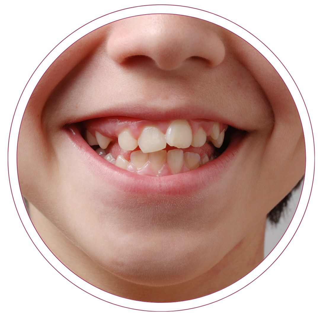 Aparelho ortodôntico novo hamburgo - rs